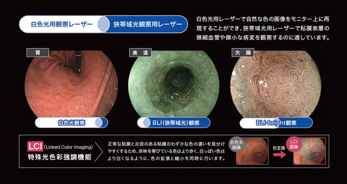 経鼻内視鏡