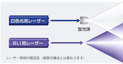 経鼻内視鏡検査