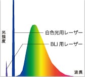 白色光観察／FICE観察